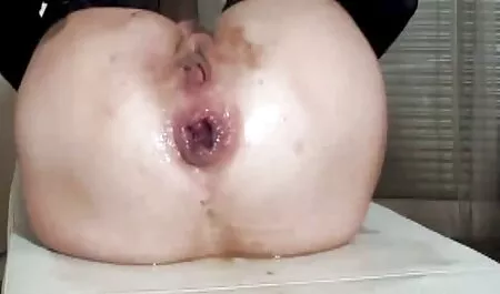 Khổ và giả hen tai nhat ban